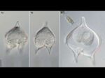 protoperidinium_claudicans