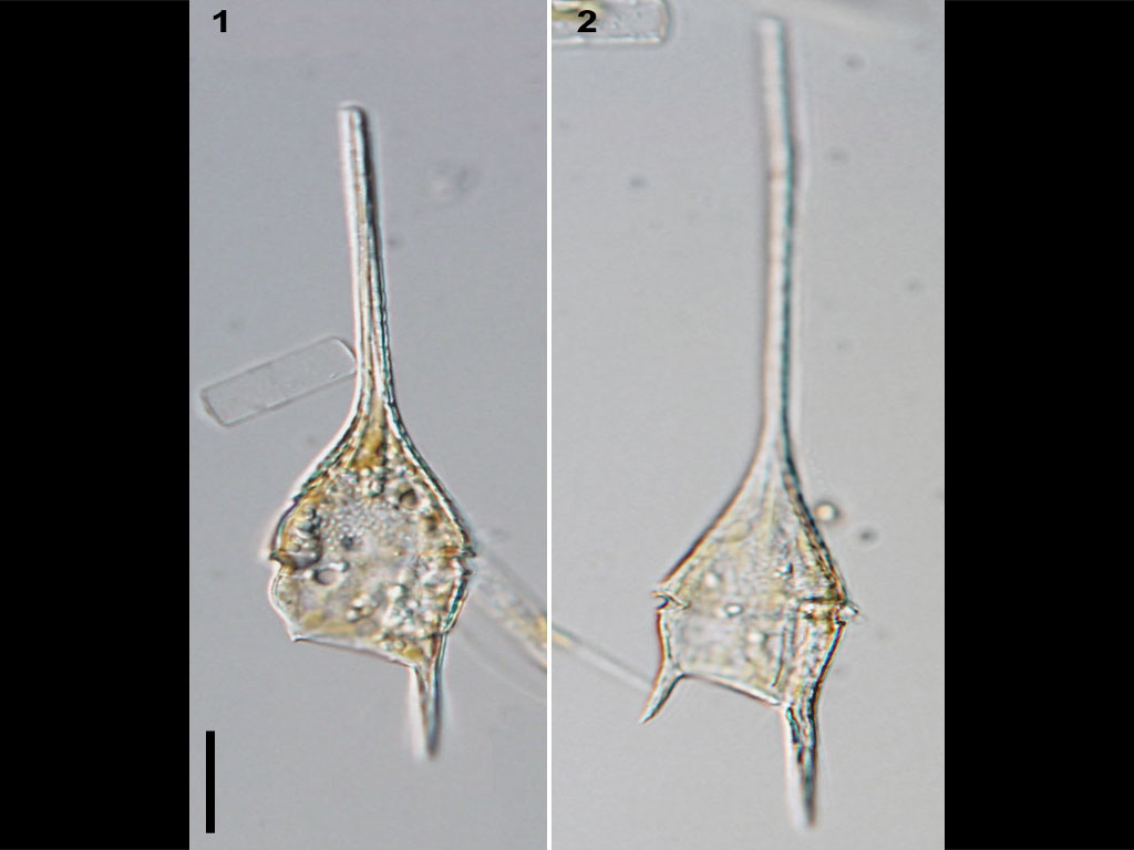 Neoceratium teres
