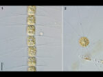 Bacteriastrum hyalinum