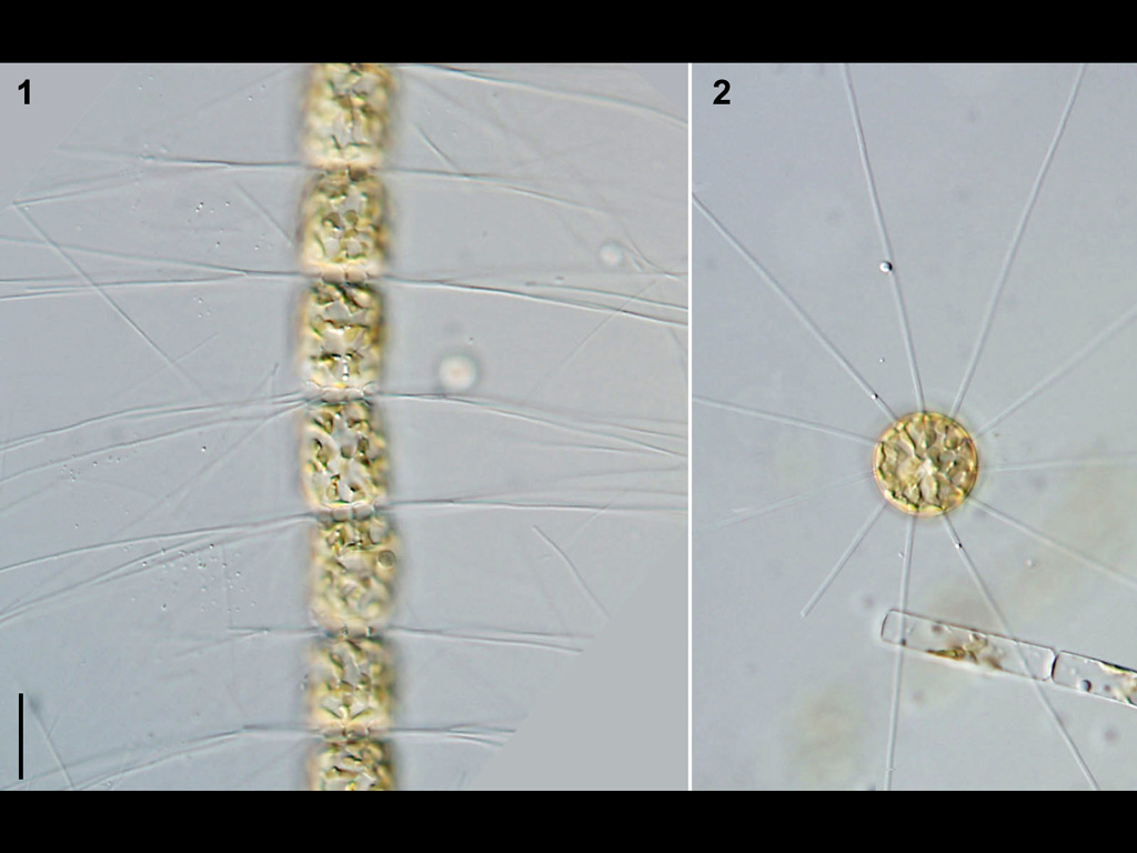 Bacteriastrum hyalinum