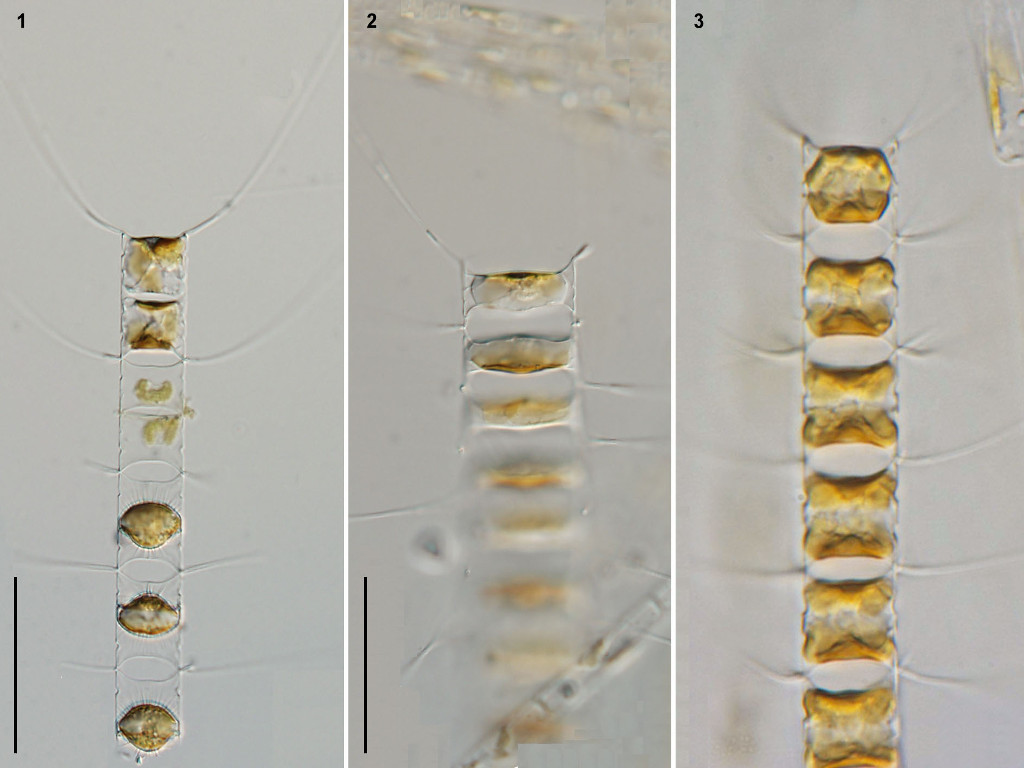 Chaetoceros constrictus