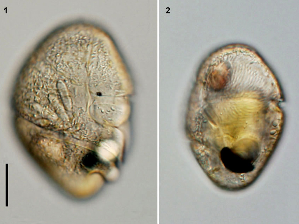 Nematodinium armatum