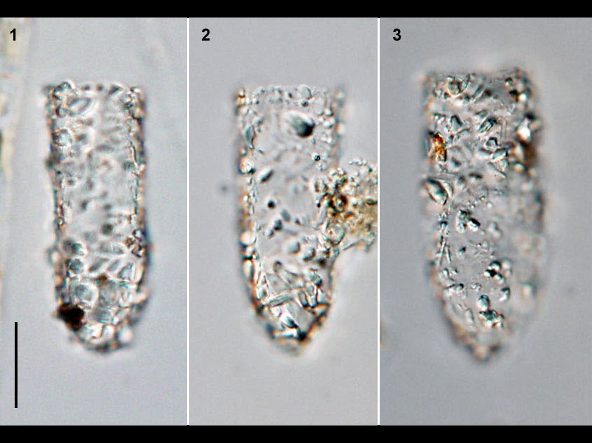 Tintinnopsis beroidea