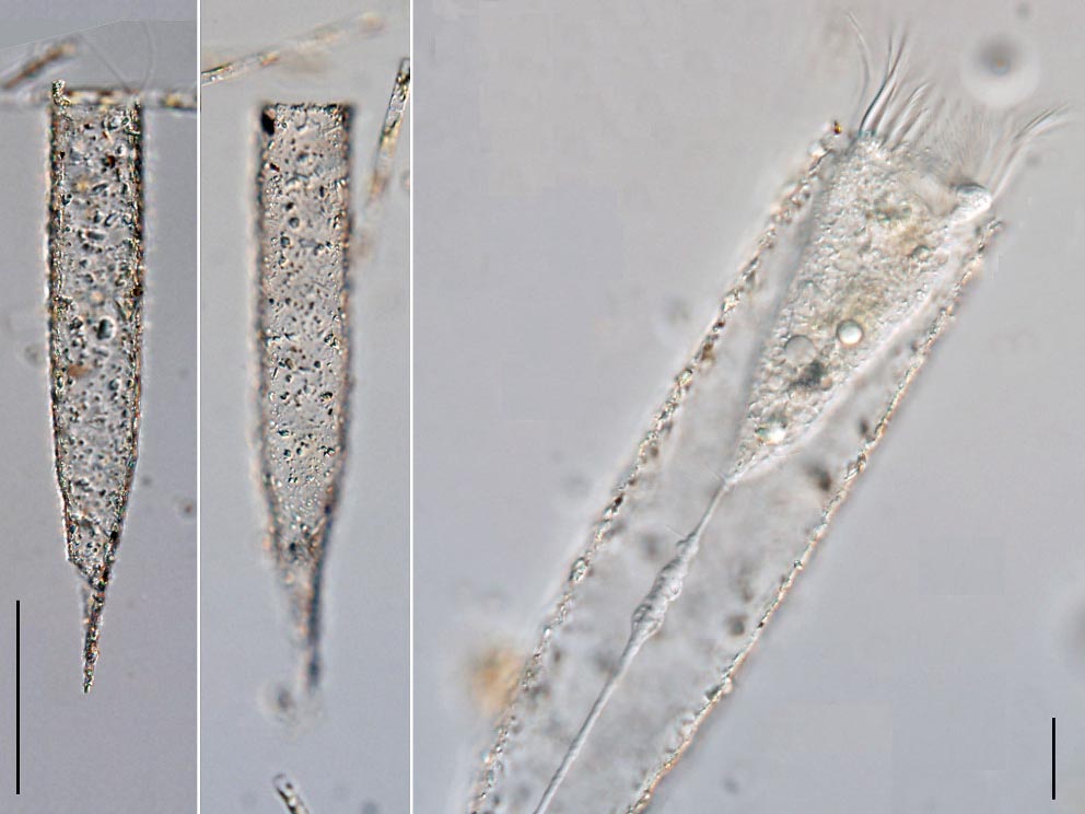 Tintinnopsis radix