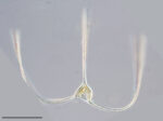 Neoceratium trichoceros