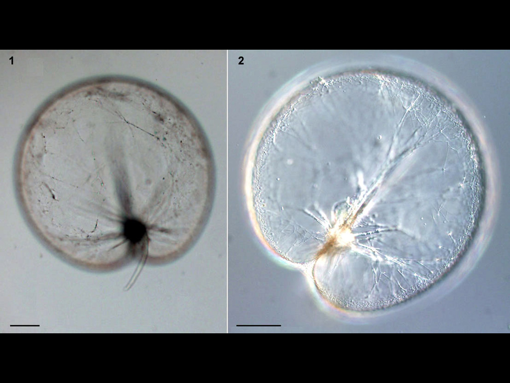 Noctiluca scintillans