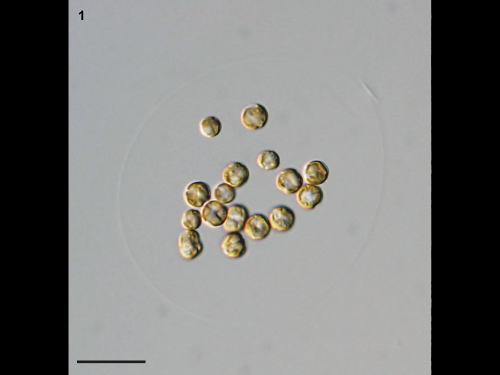 Phaeocystis globosa