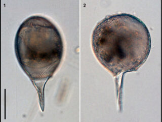 Protocystis xiphodon