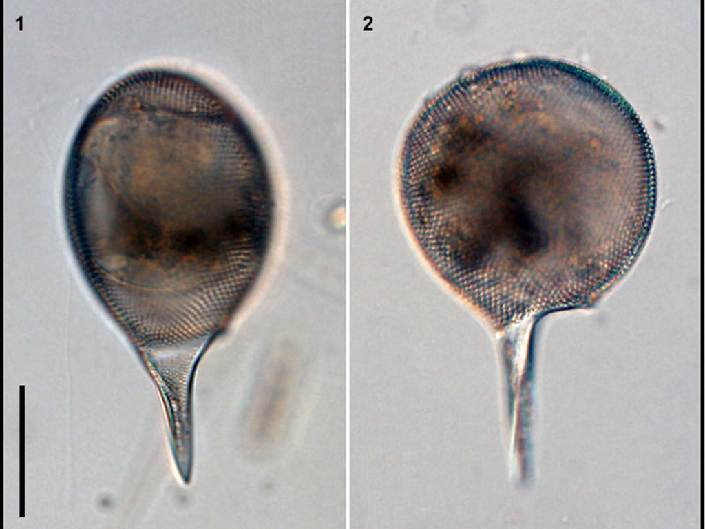 Protocystis xiphodon