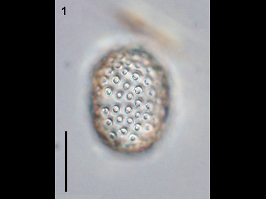 Umbilicosphaera sibogae