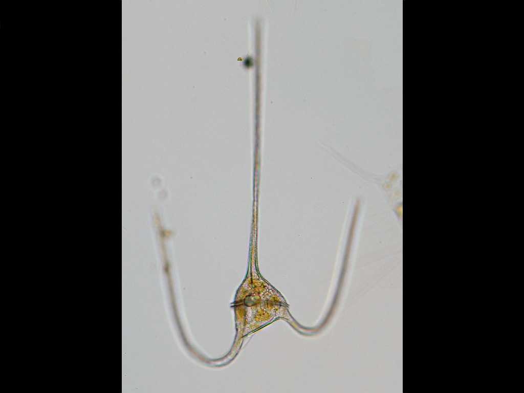 Neoceratium macroceros