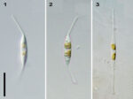 Ceratoneis closterium