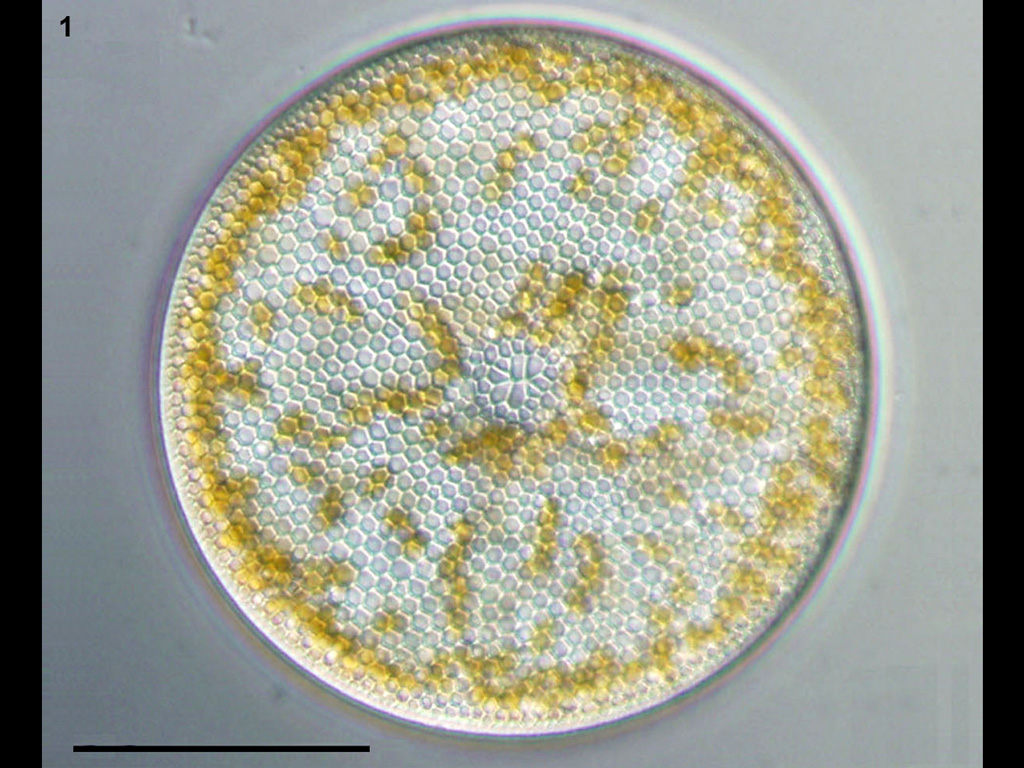 Coscinodiscus radiatus