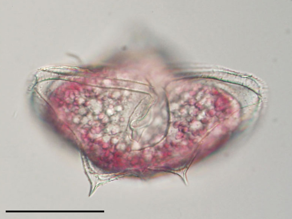 Protoperidinium pentagonum