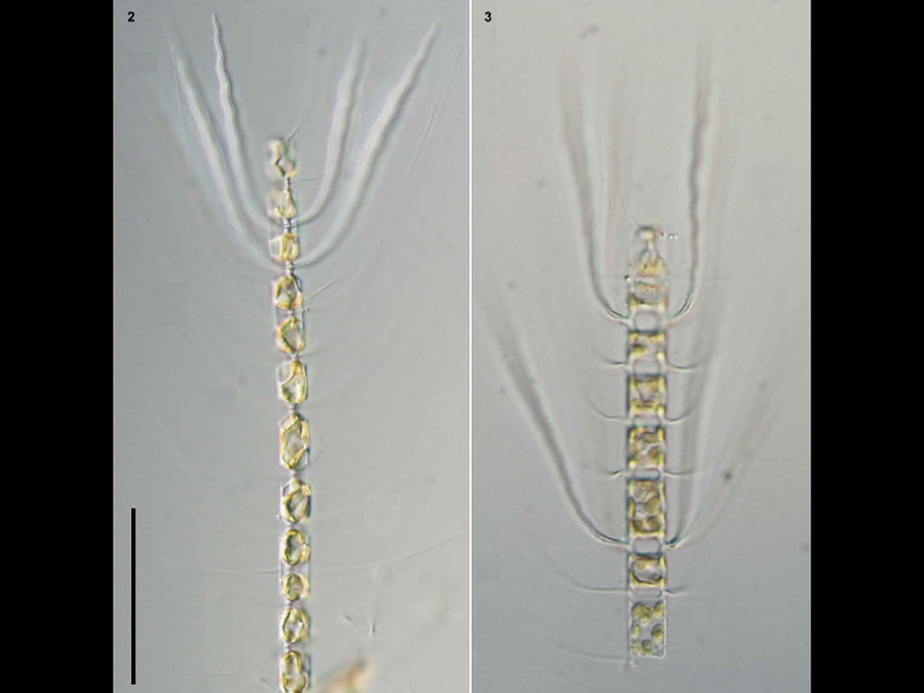 Chaetoceros contortus