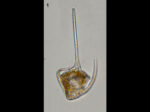 Neoceratium gibberum