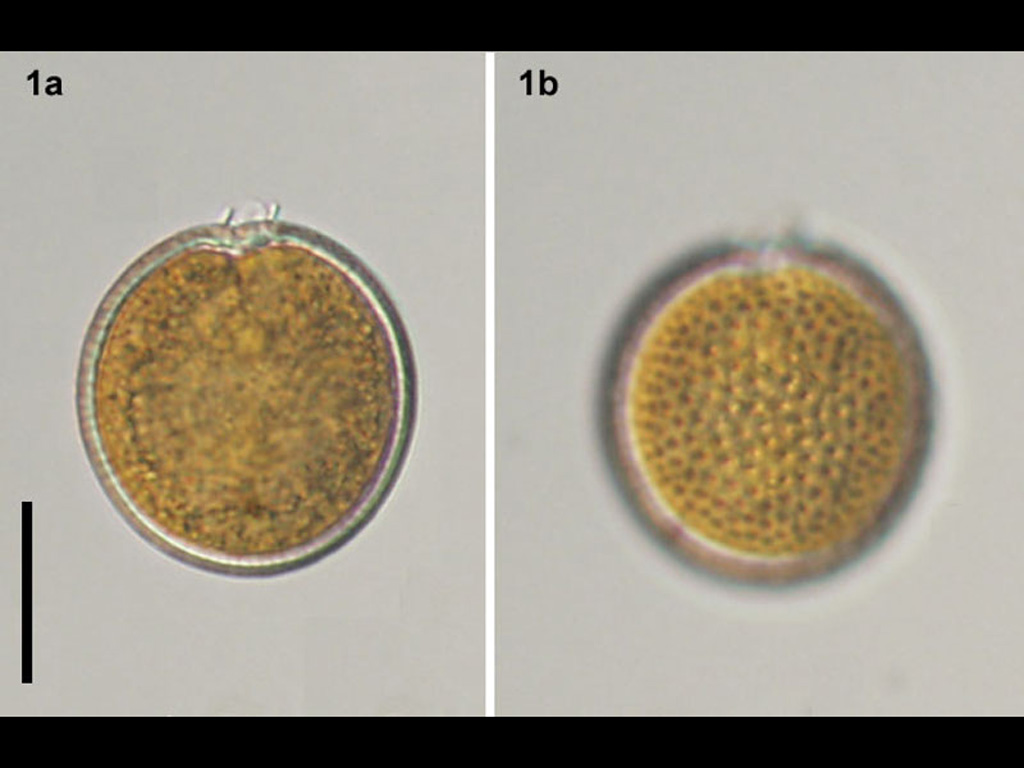 Tryblionella compressa