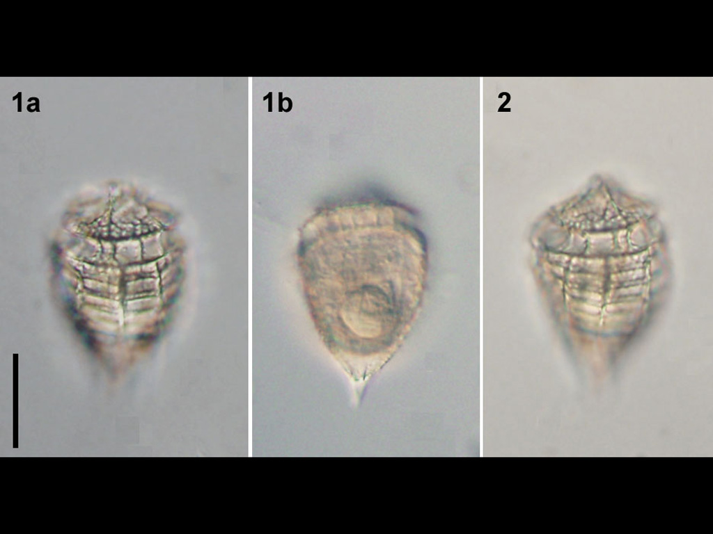 Corythodinium tesselatum