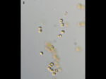 Phaeocystis globosa