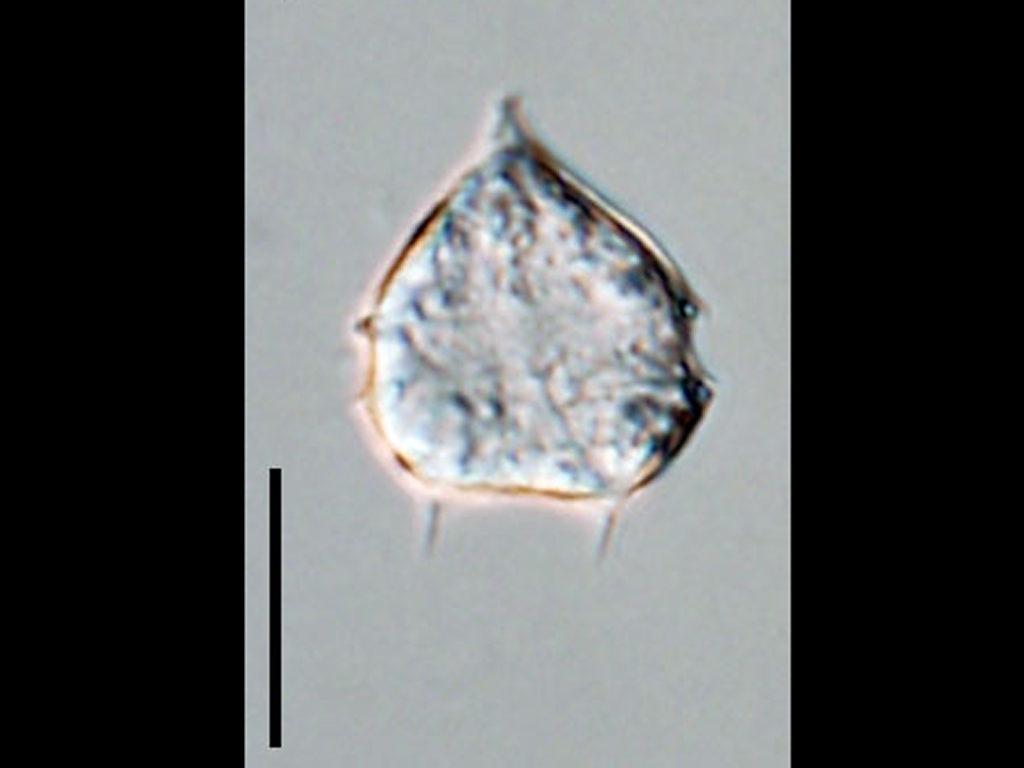 Protoperidinium bipes